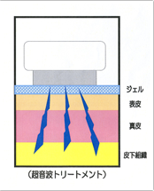 図：肌の断面図